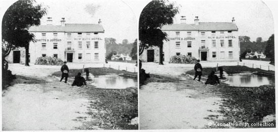 Stereoview
